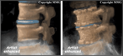 Why having an MRI may cause more harm than good